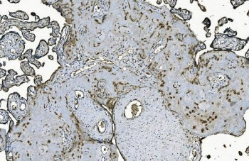 IHC staining of FFPE human placenta with DNAJC10 antibody. HIER: boil tissue sections in pH8 EDTA fo