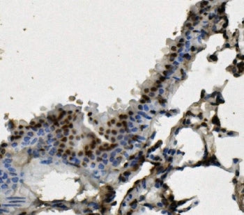 AUF1 Antibody / hnRNP D / HNRNPD