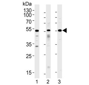 Western blot testing of 1) human A549, 2) human HepG2 and 3) rat testis lysate with ALK2 antibody at