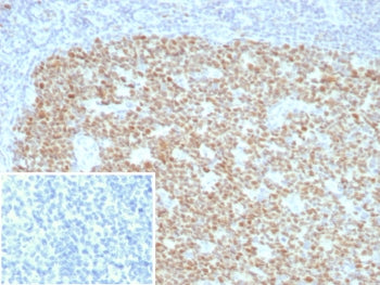 IHC staining of FFPE human tonsil tissue with BCL-6 antibody (clone BCL6/8928R). Inset: PBS used in 