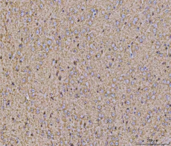 IHC staining of FFPE mouse brain tissue with Calcineurin A antibody. HIER: boil tissue sections in pH8 EDTA for 20 min and allow to cool before testing.