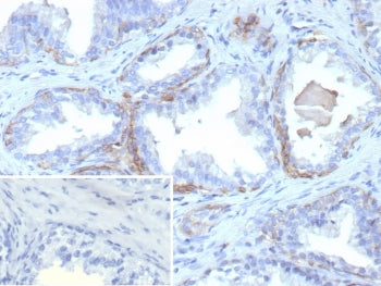 Cytokeratin 13 Antibody / KRT13