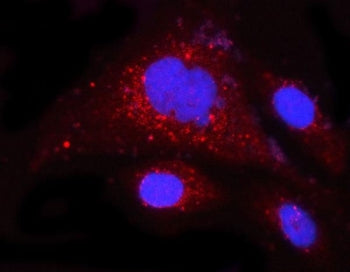 Immunofluorescent staining of FFPE human PC-3 cells with Myeloid cell leukemia 1 antibody (red) and 