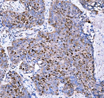 p57 Antibody / p57Kip2