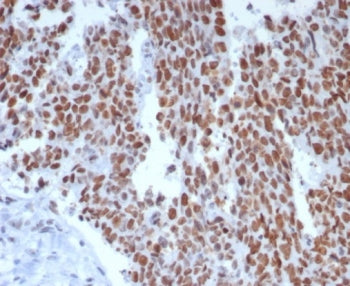 IHC staining of FFPE human small intestine tissue with MSH6 antibody (clone rMSH6/8181). HIER: boil 