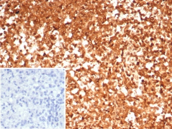 HSP90 alpha Antibody / HSP90AA1