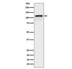 Western blot testing of lysate from pervanadate-treated human Jurkat cells with Phospho-CBL antibody