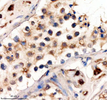 IHC staining of FFPE human testis tissue with DOT1L antibody, HRP-secondary and DAB substrate. HIER: