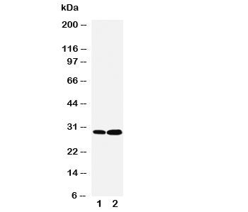 Western blot testing of LASP1 antibody and Lane 1: HeLa; 2: MCF-7 cell lysate. Predicted molecular w