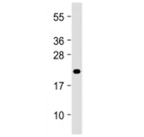 Western blot testing of MIF4GD antibody at 1:2000 + mouse liver lysate. Predicted molecular weight ~