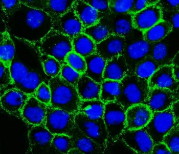P-Cadherin Antibody / CDH3