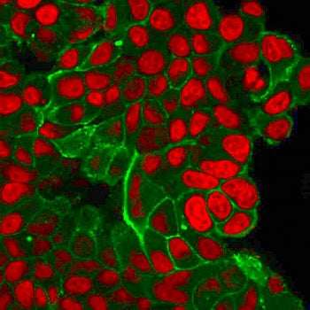 Immunofluorescent staining of PFA-fixed human MCF7 cells with HER2 antibody (clone ERBB2/2452, green