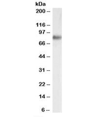 Western blot testing of human adrenal gland lysate with SRB1 antibody at 0.03ug/ml. Predicted molecu