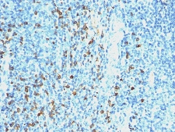 IHC: Formalin-fixed, paraffin-embedded human tonsil stained with anti-Lambda antibody (clone SPM559)