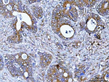 PDXDC1 Antibody / Pyridoxal-dependent decarboxylase domain-containing protein 1