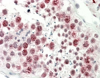 IHC testing of FFPE human testis with DNAJC5G antibody at 5ug/ml. HIER: steamed with pH6 citrate buf