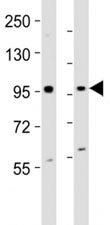 EZH2 Antibody
