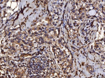 PDIA6 Antibody / ERp5