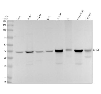 Western blot analysis of GNAQ using anti-GNAQ antibody. Electrophoresis was performed on a 10% SDS-P