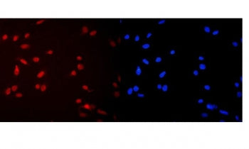 Immunofluorescent staining of FFPE human U-2 OS cells with MCM2 antibody (red) and DAPI nuclear stai
