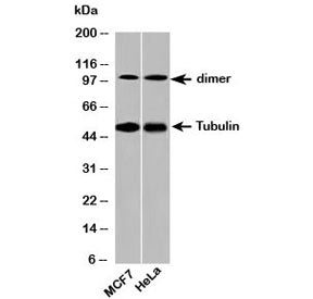 Western blot testing of human samples with beta Tubulin antibody at 2ug/ml. Predicted molecular weig