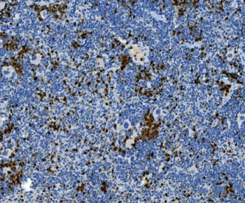 Myeloperoxidase Antibody / MPO
