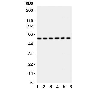 Western blot testing of AKT2 antibody and Lane 1: HeLa; 2: PANC; 3: A549; 4: COLO320; 5: HT1080; 6: 