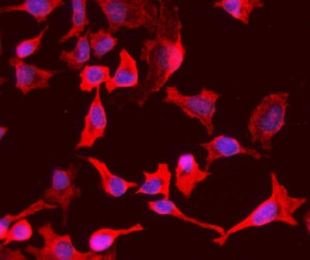 PCK1 Antibody / PEPC