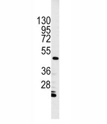 Western blot analysis of Integrin linked kinase antibody and HL-60 cell lysate. Expected molecular w