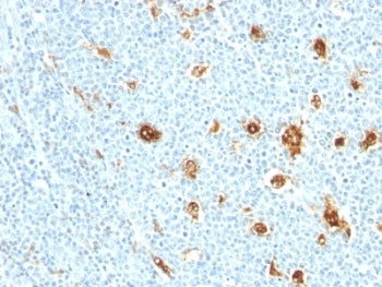S100A9 Antibody / MRP14 / Calgranulin B / Calprotectin L1H