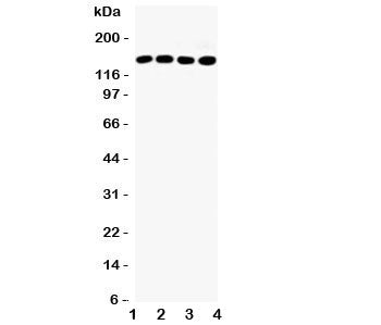 Western blot testing of IRS-1 antibody and Lane 1: HeLa; 2: A549; 3: 293T; 4: MCF-7 lysate, Expected