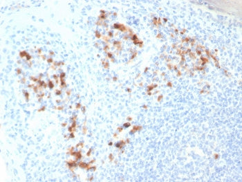 IHC staining of FFPE human tonsil tissue with Syndecan-1 antibody (clone SDC1/7182). HIER: boil tiss