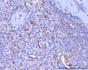 ITGA2B Antibody / Integrin alpha 2b