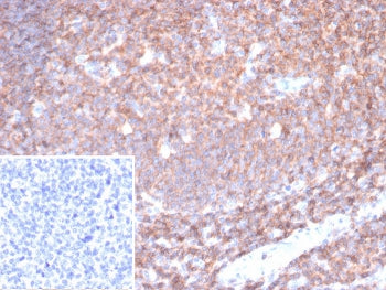 IHC staining of FFPE human tonsil tissue with CD45 antibody (clone PTPRC/6780). Inset: PBS used in p