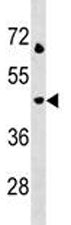 LAMP3 antibody western blot analysis in Jurkat lysate. Predicted molecular weight: ~44 kDa.