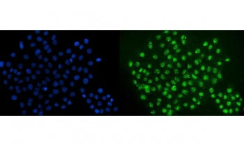 Immunofluorescent staining of FFPE human A431 cells with ERG antibody (green) and DAPI nuclear stain