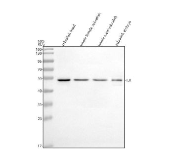 Western blot analysis of Integrin-linked kinase protein using Integrin-linked kinase antibody and 1)