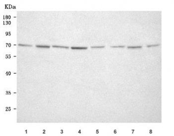 Western blot testing of 1) human SH-SY5Y, 2) human K562, 3) human Jurkat, 4) human U-251, 5) rat bra