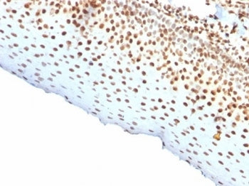 Nuclear Antigen Antibody