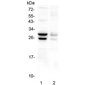 Western blot testing of 1) mouse liver and 2) mouse stomach lysate with COMT antibody at 0.5ug//ml. 