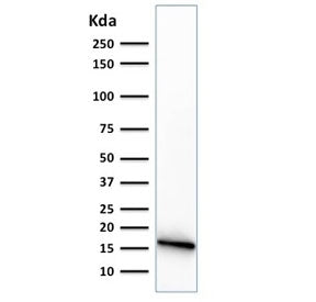 CELA3B Antibody / Elastase 3B