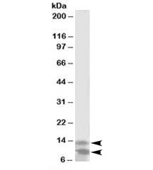 Western blot testing of K562 lysate with DPM3 antibody at 2ug/ml. Predicted molecular weight: ~10/13