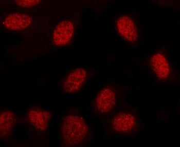 Immunofluorescent staining of FFPE human U-2 OS cells with MINDY3 antibody (red). HIER: steam sectio