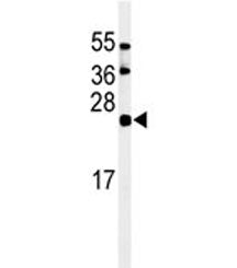 ISG15 Antibody