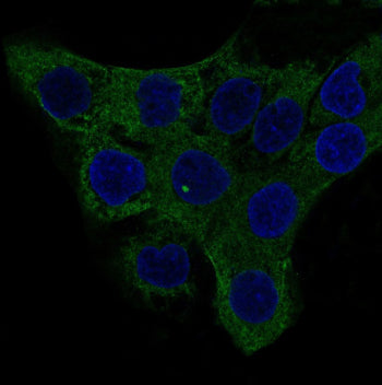 Immunofluorescent staining of FFPE human A431 cells with ACTA2 antibody (green) and DAPI nuclear sta