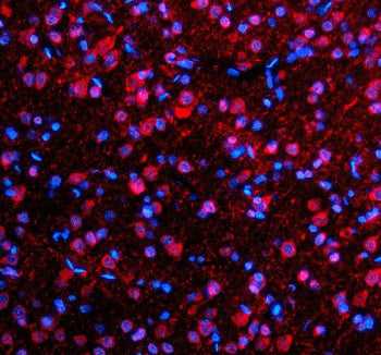 Immunofluorescent staining of SFXN4 using anti-SFXN4 antibody (red). SFXN4 was detected in a paraffi