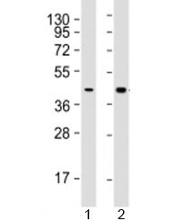 Western blot testing of human 1) HepG2 (liver carcinoma line) and 2) liver lysate with AGXT antibody