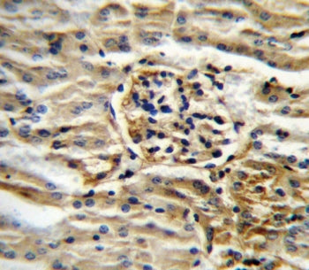 IHC testing of FFPE mouse kidney tissue with CYP11B2 antibody. HIER: steam section in pH6 citrate bu