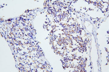 mGluR1 Antibody / GRM1