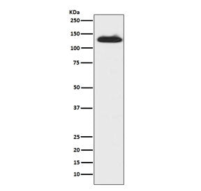 Western blot testing of human fetal lung lysate with c-Kit antibody. Observed molecular weight: ~120